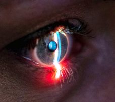 Laserowa korekcja wzroku po 50. roku życia: korzyści, ograniczenia i efektywność zabiegu