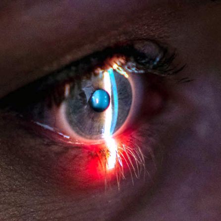 Laserowa korekcja wzroku po 50. roku życia: korzyści, ograniczenia i efektywność zabiegu
