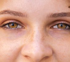 Odklejenie siatkówki – przyczyny i objawy odwarstwienia siatkówki. Diagnostyka, leczenie