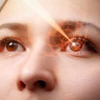 Laser YAG w irydotomii i kapsulotomii – zabiegi laserem neodymowym