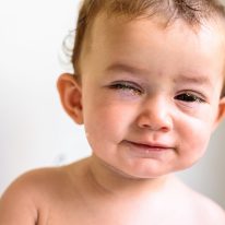 Ropiejące oczy u dzieci i dorosłych – przyczyny, objawy i leczenie