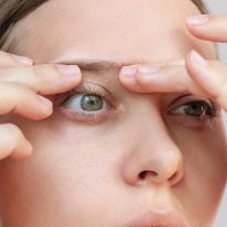 Cysta na oku – przyczyny, objawy, leczenie. Jak można ją usunąć?