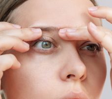 Cysta na oku – przyczyny, objawy, leczenie. Jak można ją usunąć?