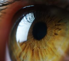 Retinopatia barwnikowa – co warto o niej wiedzieć?