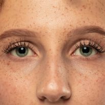 Jakie są przyczyny różnowzroczności i kiedy się pojawia ta wada?