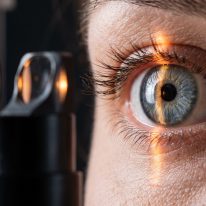 Laserowa korekcja astygmatyzmu: kompleksowy przewodnik po nowoczesnych metodach leczenia