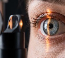 Laserowa korekcja astygmatyzmu: kompleksowy przewodnik po nowoczesnych metodach leczenia